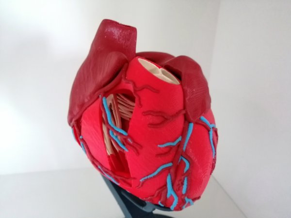 Anatomic Heart (multi material)